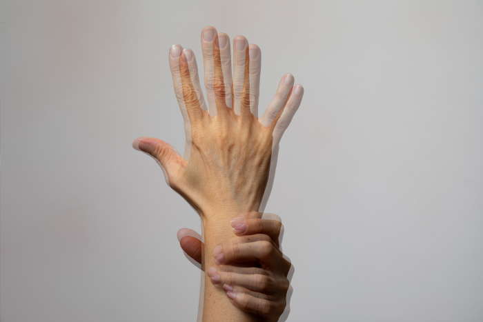double vision of hand holding wrist